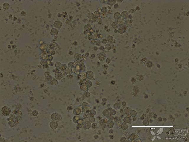 什么是黑色瘤 3230159384354566448-8w.jpg!w640