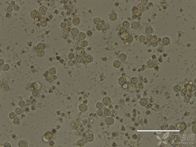 什么是黑色瘤 3230159326372484068-8w.jpg!w640