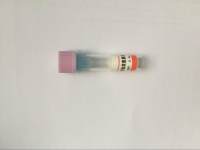 辣根过氧化物酶标记的羊抗兔IgG