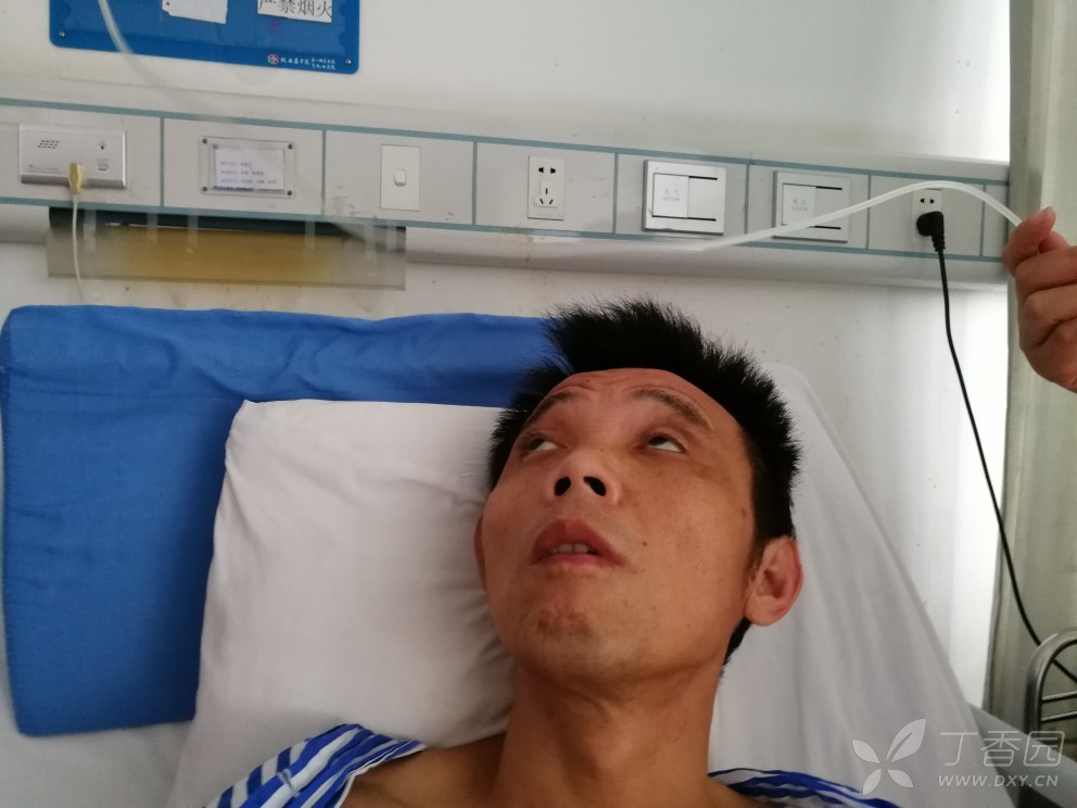 脑梗后眼神 - 神经科学专业讨论版 -丁香园论坛