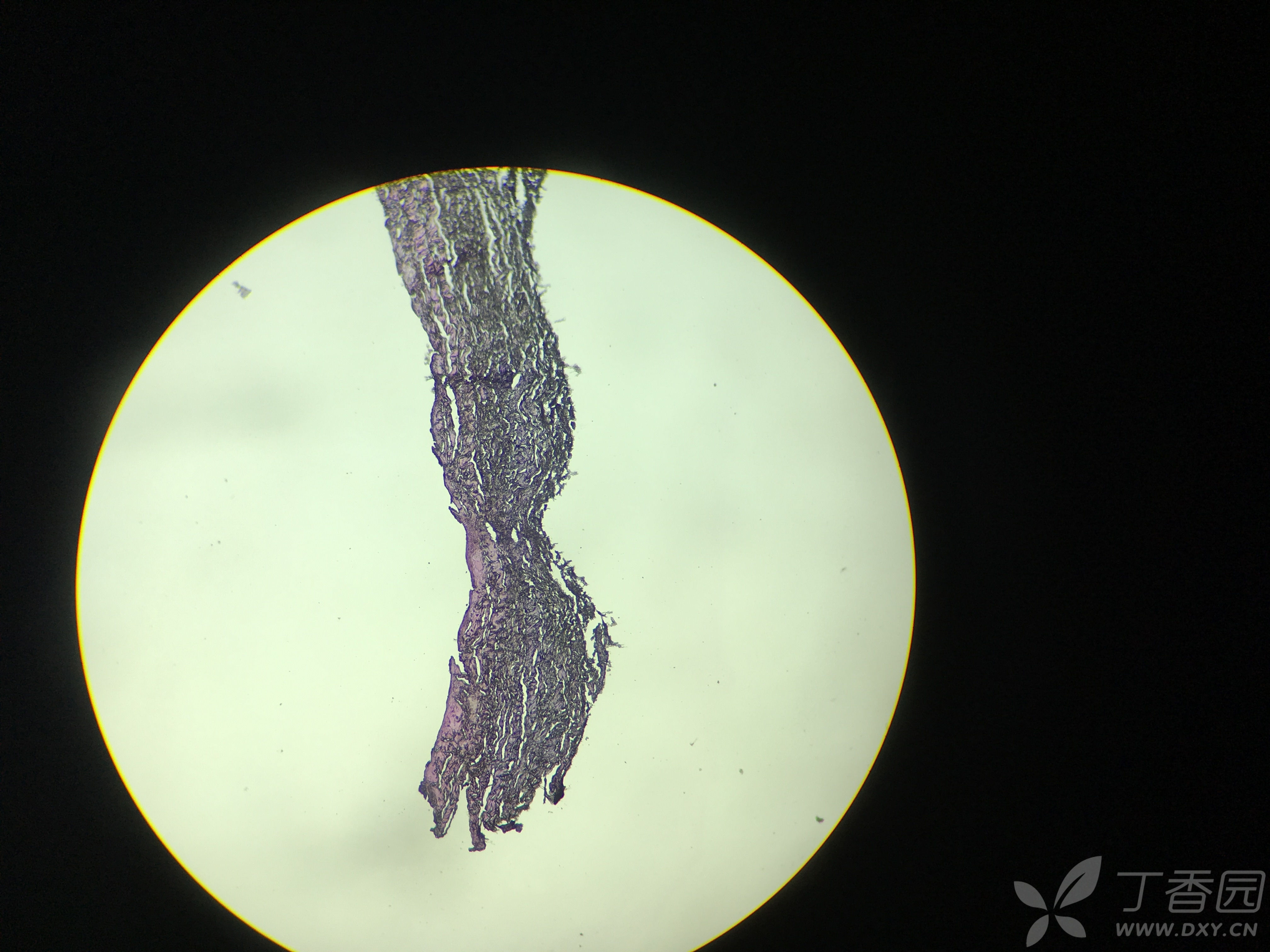 骨膜he染色,总体基调发黑,有哪位大神指导一下.