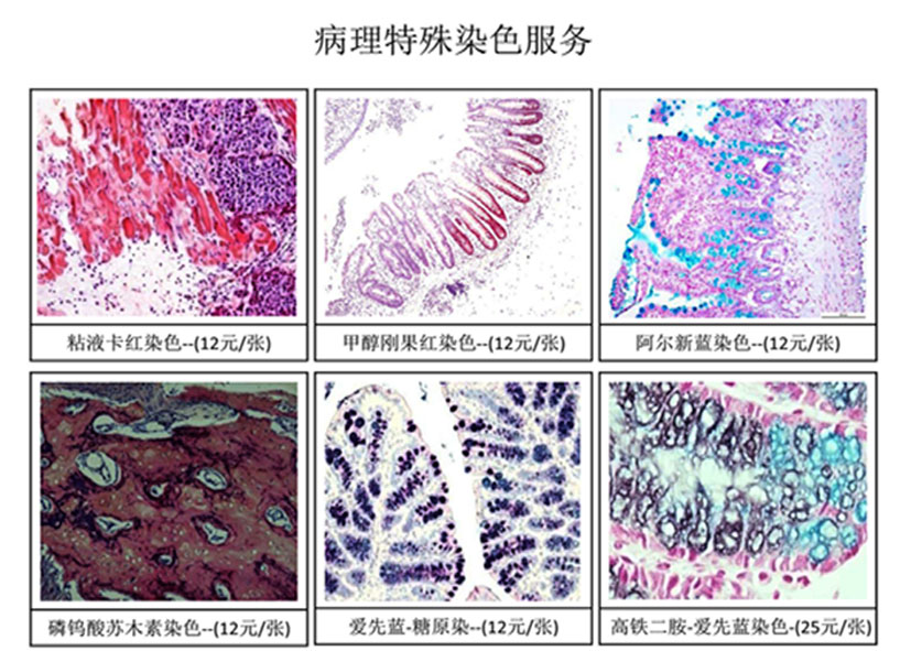 病理特殊染色服务