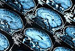 神经科医生不可不知的典型头颅 MRI 特点