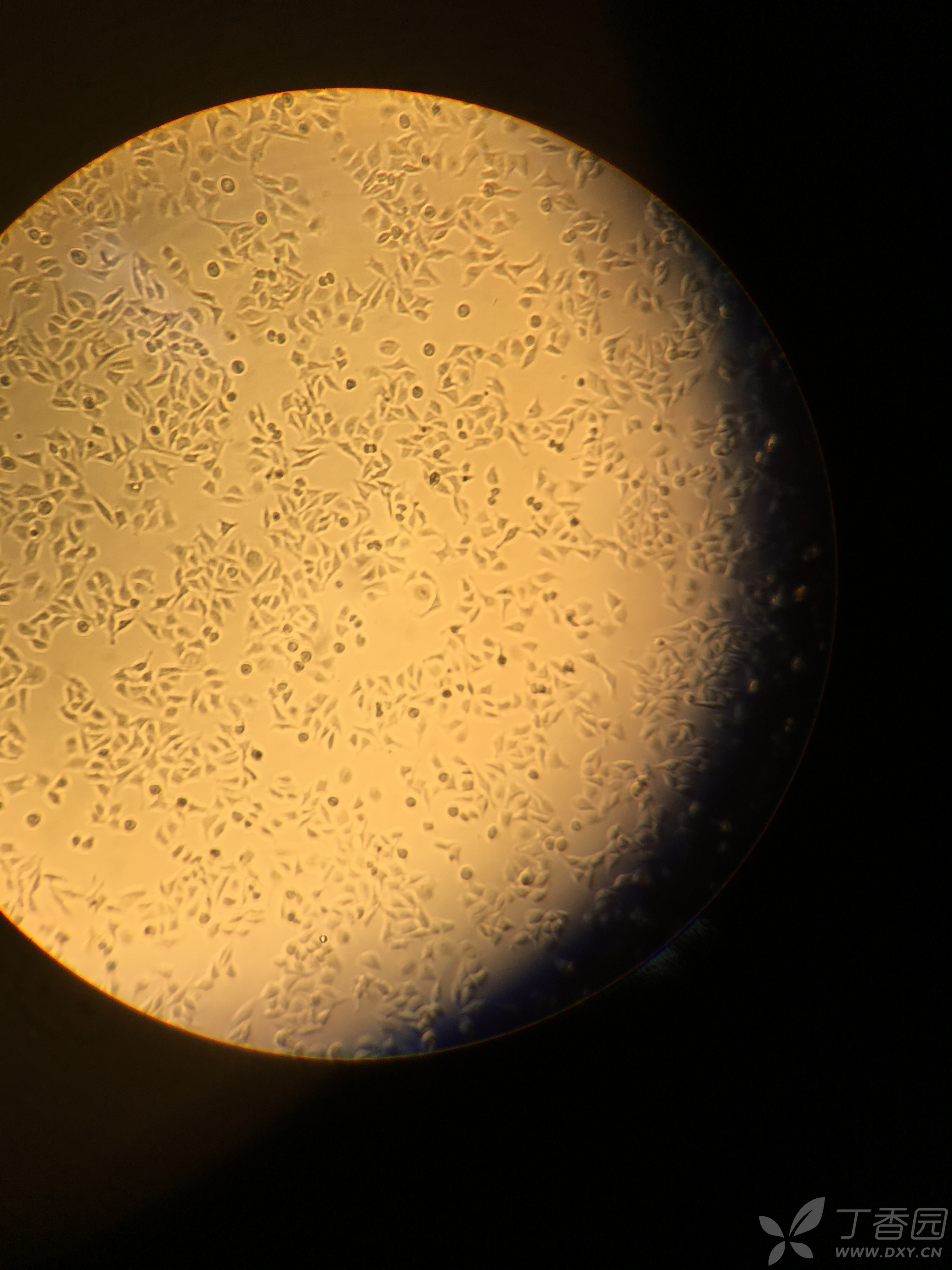 下面哪种形态是lo2细胞