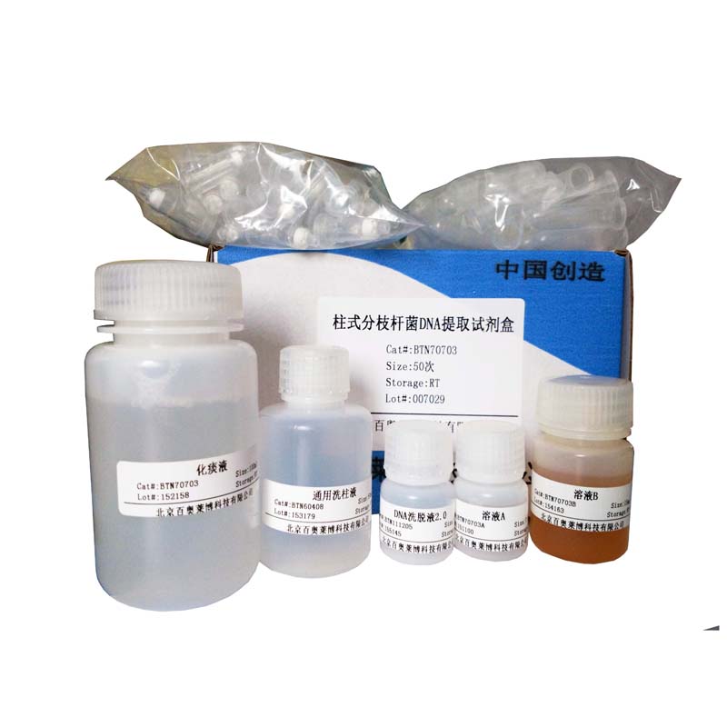 血清铁浓度检测试剂盒 生化检测试剂盒