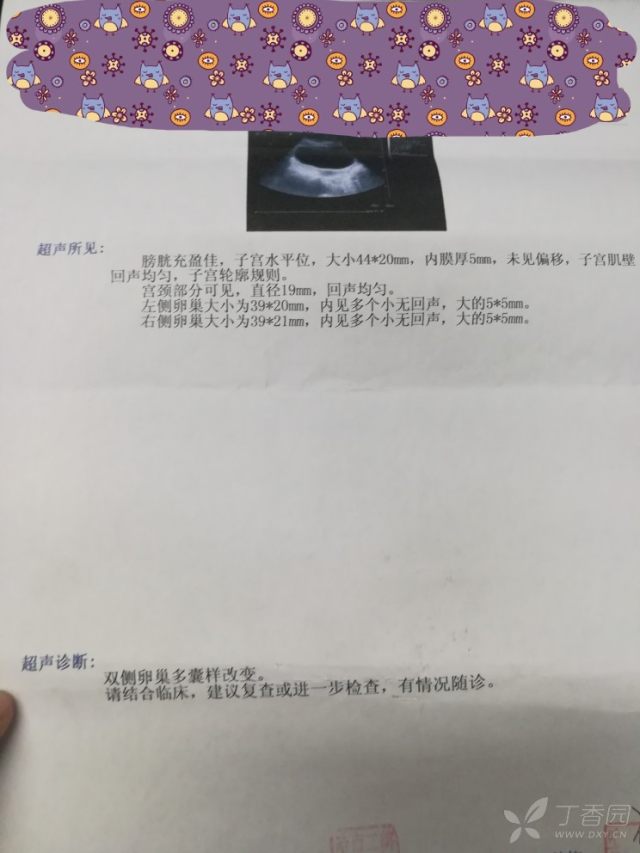 3232405901358433387-16w.jpg!w640