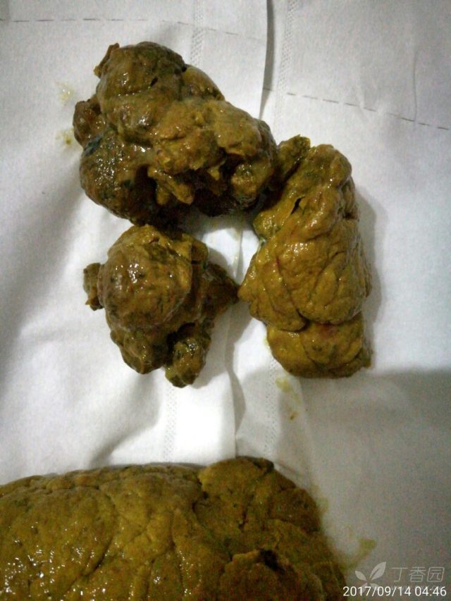 大便前段结节状,略带白色粘液.急解