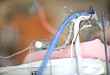 欧洲呼吸学会医院获得性／呼吸机相关性肺炎指南更新