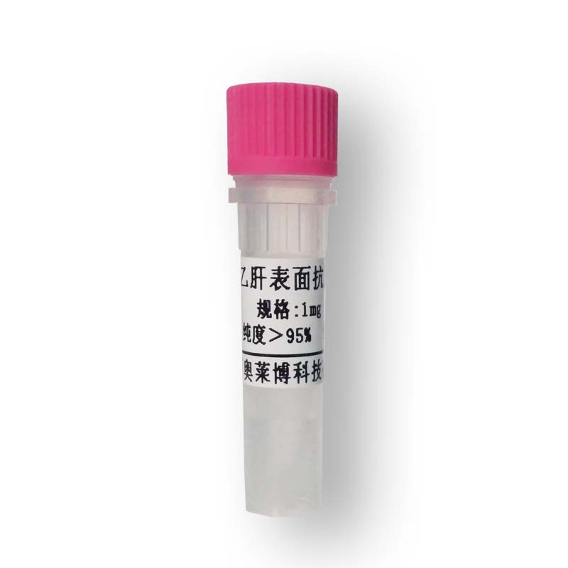 HRP标记兔抗绵羊IgG(H+L)北京厂家