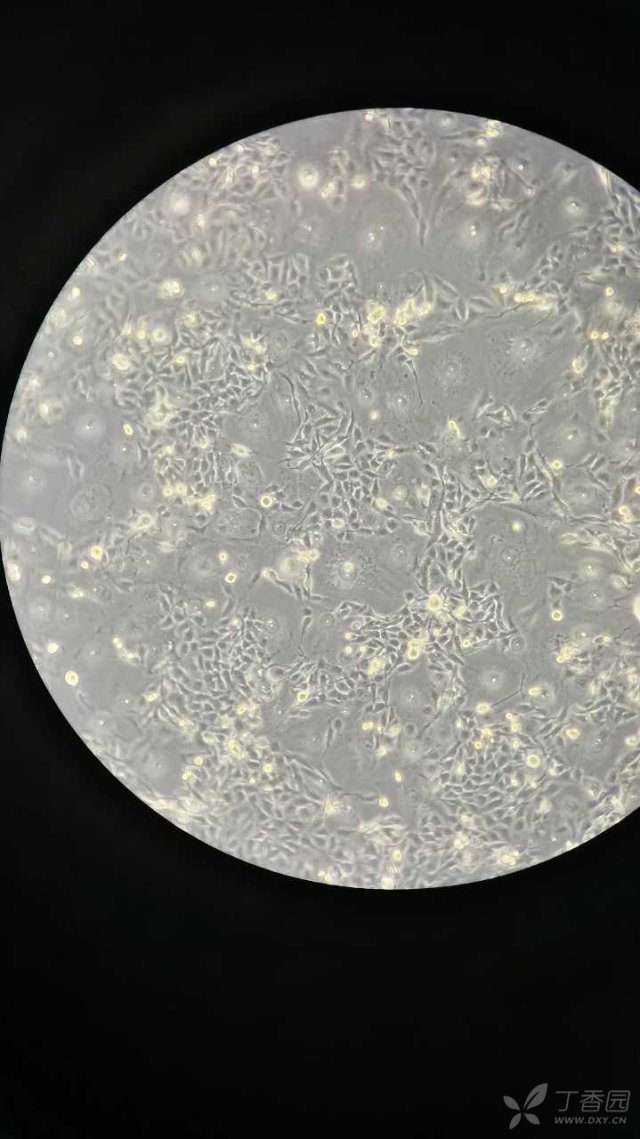 在培养乳腺癌细胞株mda-mb-231的过程中,发现传代后细胞形态出现变化