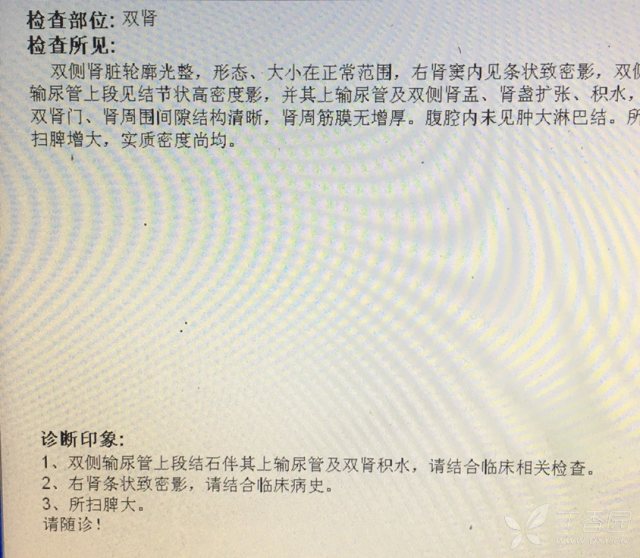 双输尿管结石严重吗 3233828446066520712-16w.jpg!w640