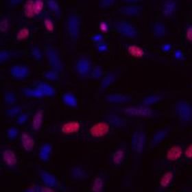 细胞生物学:BRDU 细胞增殖实验服务