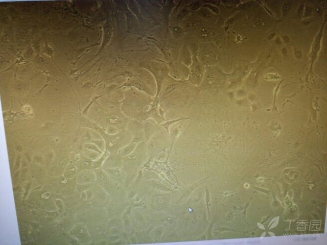 3234757275693940728-16w.jpg!w640