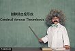 中青年卒中，这个疾病千万别漏诊
