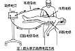 手术台上千般武器，手术要漂亮不熟悉这些怎么行