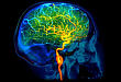 血管反应性是脑淀粉样血管病的早期敏感标志物之一
