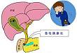 一文读懂：儿童急性胰腺炎的诊治特点