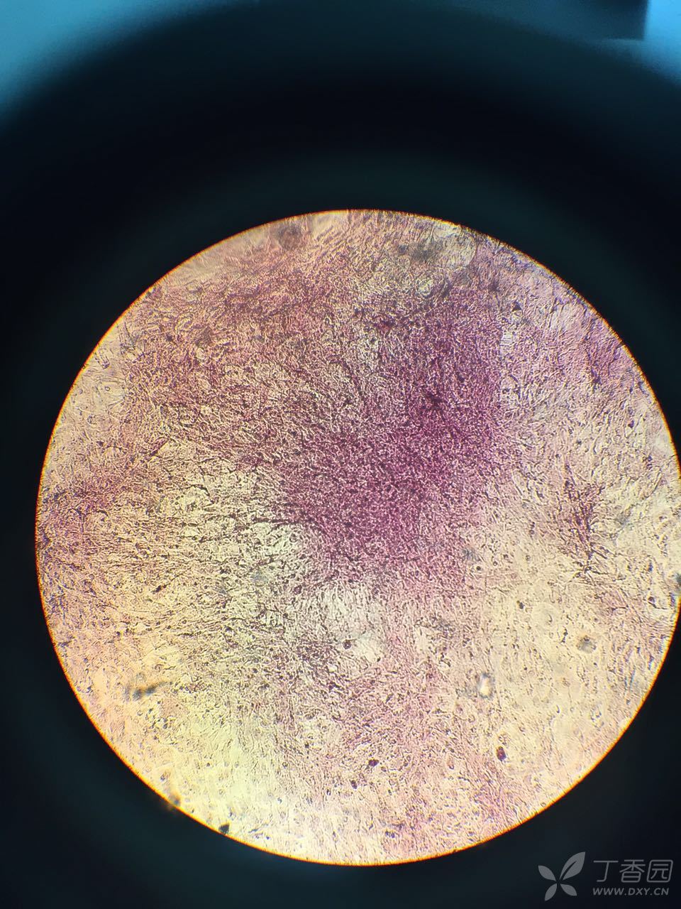 茜素红细胞染色图片