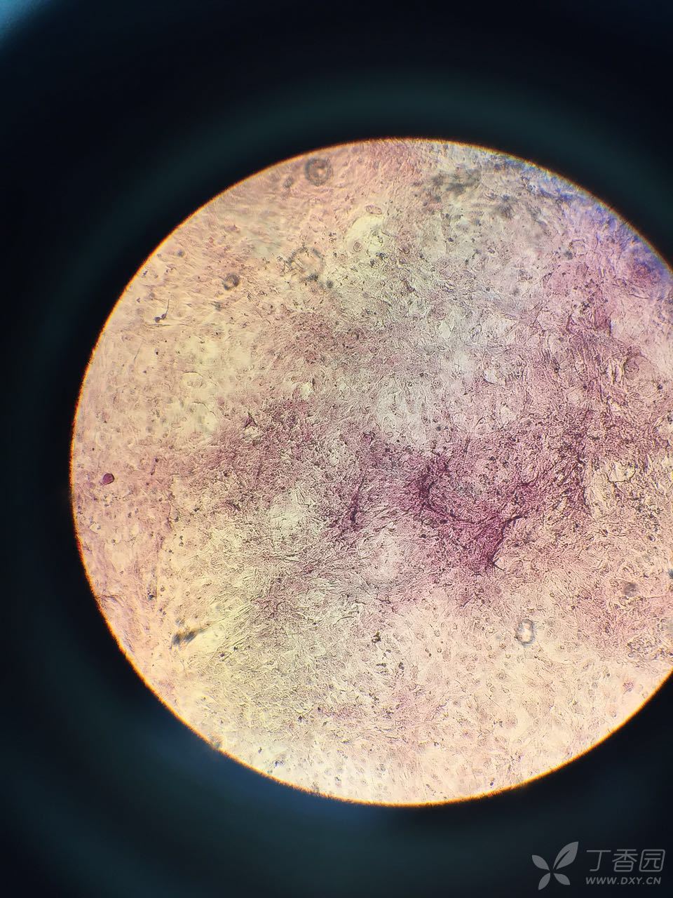 求各位大神看看这个茜素红染色能不能证明成骨细胞的钙化诱导了1周