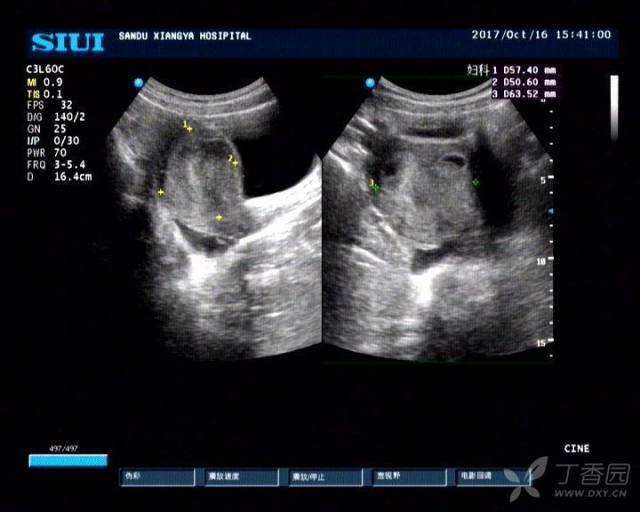 3238710049792163562-8w.jpg!w640