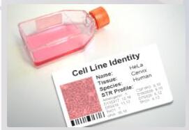 L5178Y TK+/- clone (3.7.2C)；小鼠淋巴瘤细胞