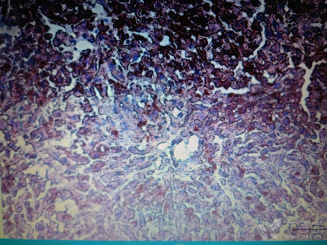 肝脏组织冰冻切片图片
