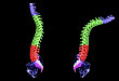 骨科教程：脊柱胸腰段骨折处理