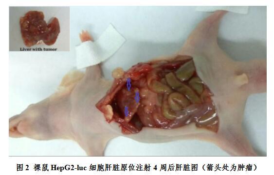 裸鼠 HepG2 细胞皮下成瘤与肝内成瘤的实验研