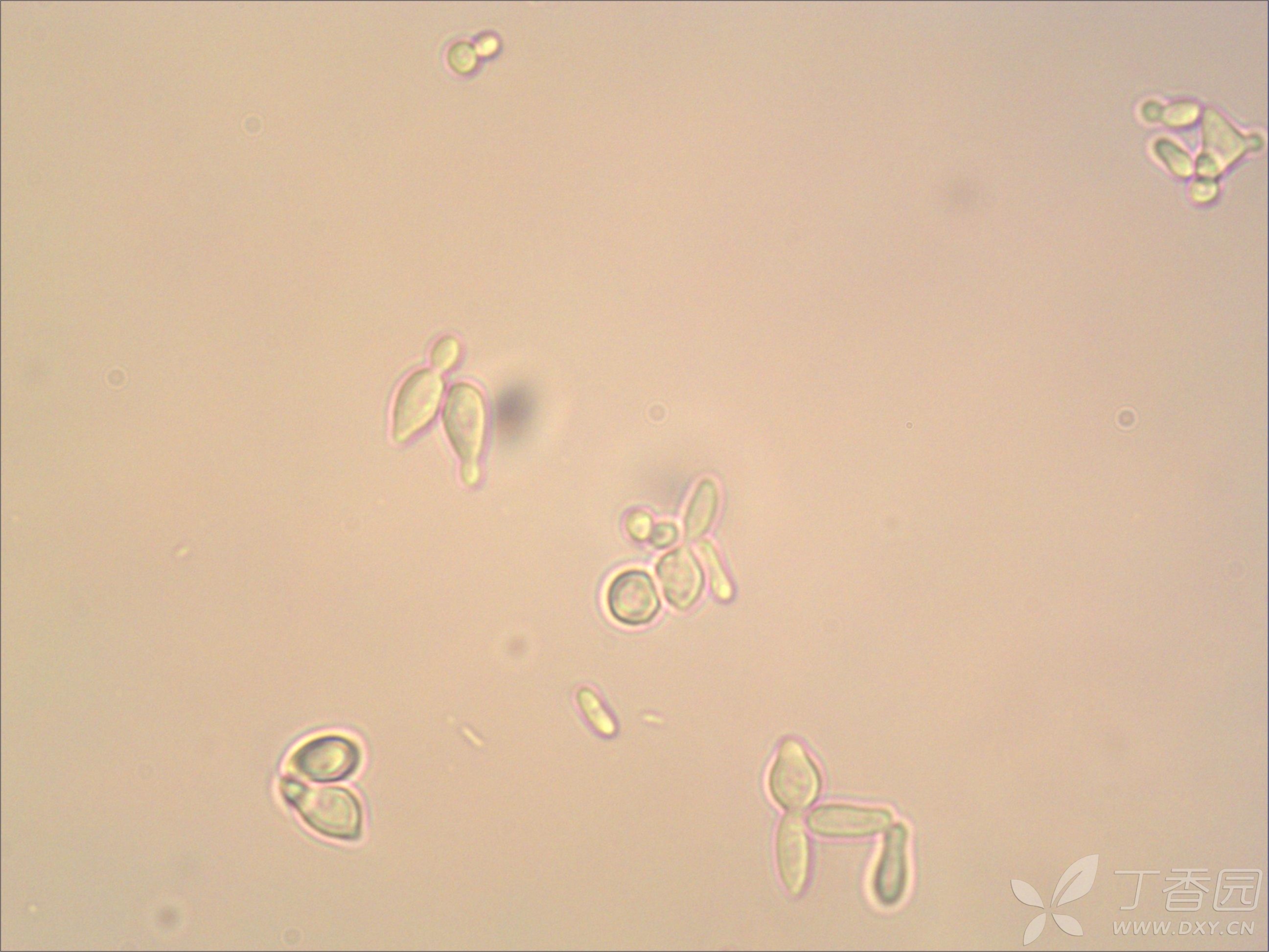 尿检酵母样菌图片