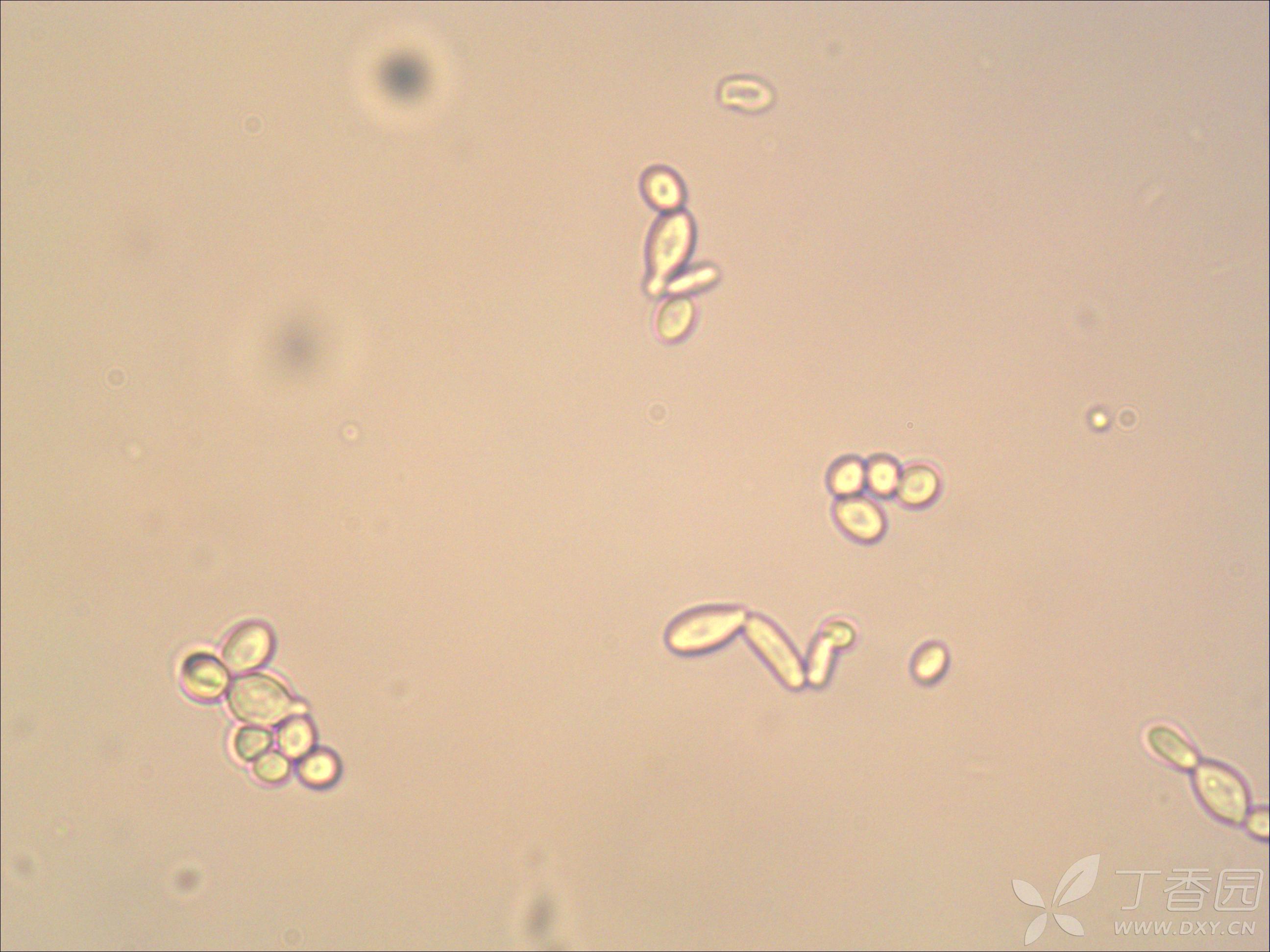 显微镜观-粪便中的细菌_哔哩哔哩_bilibili