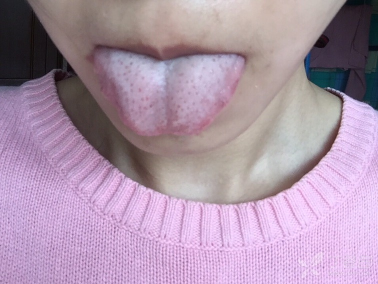 齿状锯齿舌 