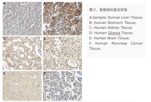 云克隆体外免疫诊断试剂原料2.png