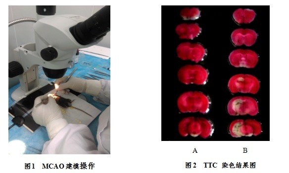 小鼠脑缺血再灌注损伤模型.png
