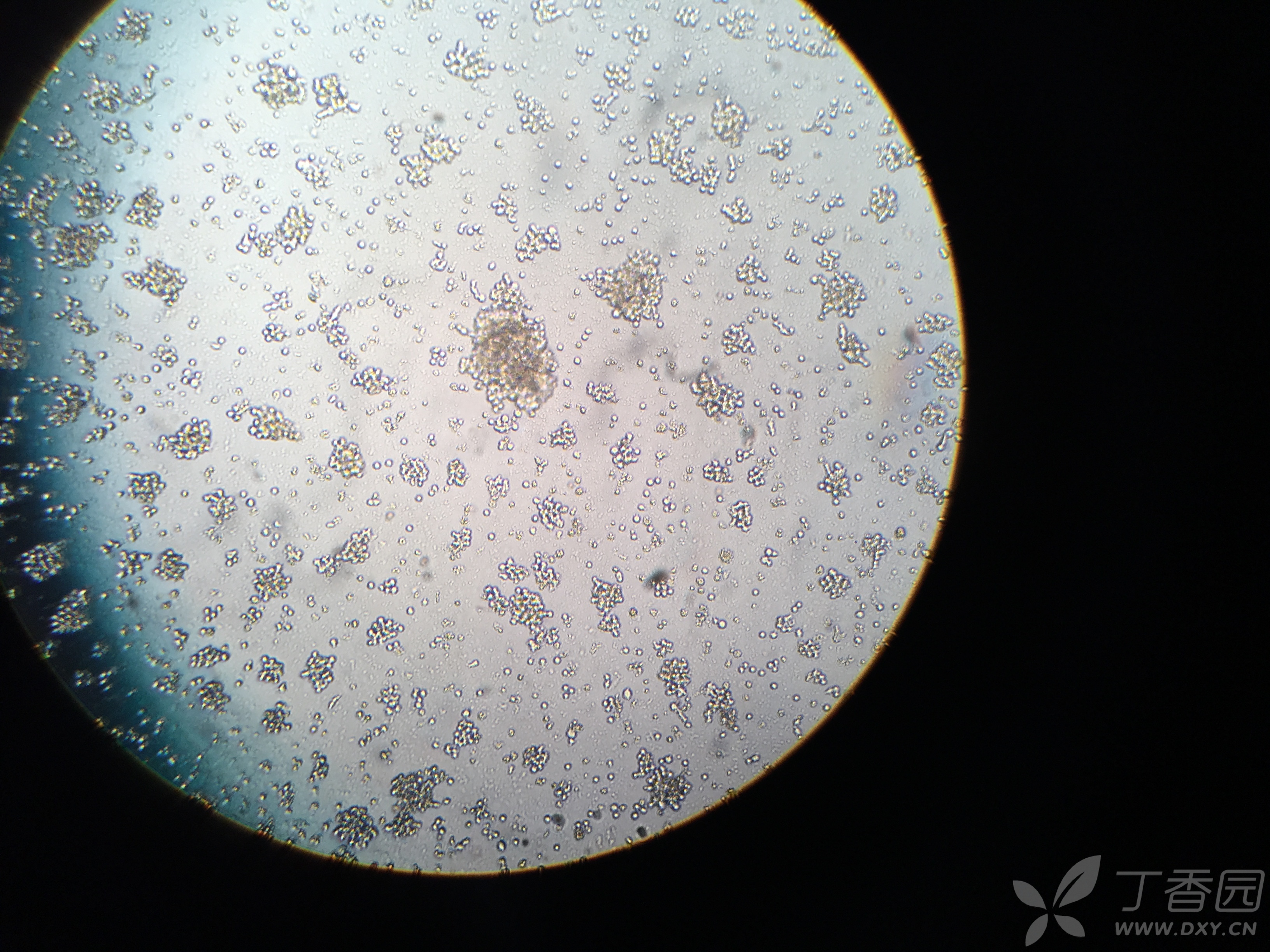 悬浮细胞,请问图片中是什么,是污染吗