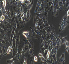 NCI-H1395 Cells