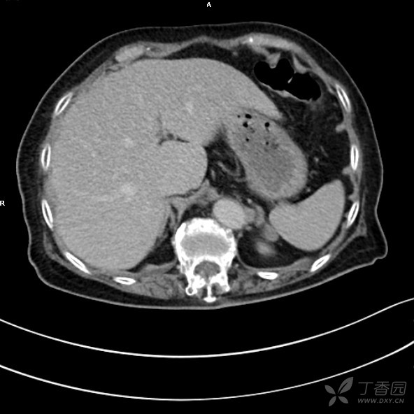 3240609275740478673-8w.jpg