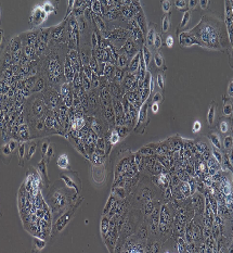 NCI-H441 Cells