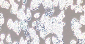 Hep G2.2.15 Cells