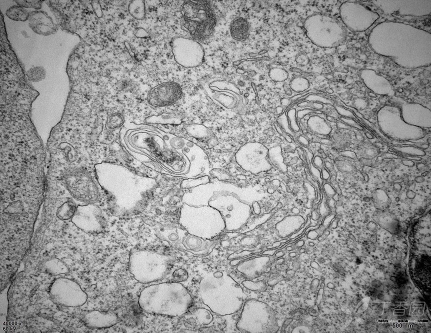 溶酶体电镜照片图片