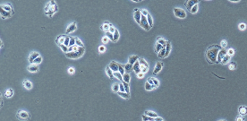 Tca-8113 Cells