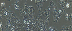 CNE1 Cells