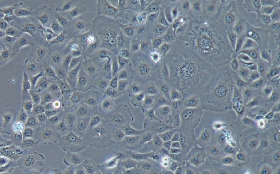 A-704 Cells