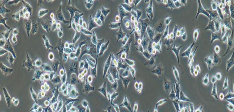 CNE2 Cells