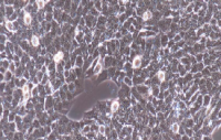 A673 Cells