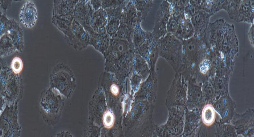 Mcf-7/adr Cells