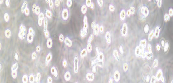 T2 (174xcem.T2 ) Cells