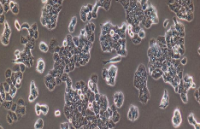 MDA-MB-435 Cells