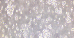 OCI-LY10 Cells