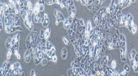 HEC-1-A Cells