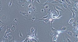 HMEC-1 Cells
